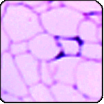 adipose tissue